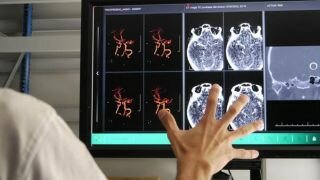 Surgeons May Use Hand Gestures to Manipulate MRI Images in OR
